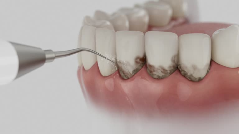 Reliable Dental Implants contractor in Leawood, KS by Smile Center Dentistry
